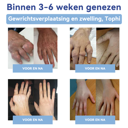 ✅𝐀𝐦𝐬𝐭𝐞𝐫𝐝𝐚𝐦 𝐔𝐌𝐂 𝐅𝐮𝐧𝐜𝐭𝐢𝐨𝐧𝐚𝐫𝐢𝐬: 𝐒𝐏𝐙𝐕® 𝐌𝐚𝐠𝐧𝐞𝐬𝐢𝐮𝐦 𝐩𝐢𝐣𝐧 𝐯𝐞𝐫𝐥𝐢𝐜𝐡𝐭𝐞𝐧𝐝𝐞 𝐡𝐞𝐥𝐞𝐧𝐝𝐞 𝐜𝐫è𝐦𝐞 (Behandeling van artritis, neuropathie, reumatische aandoeningen, spierspasmen, spiertrekkingen en sportblessures)