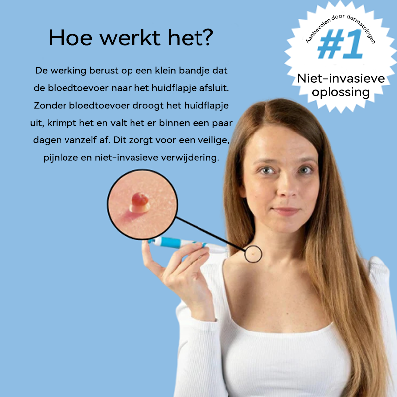 𝐉𝐚𝐬𝐬𝐞𝐞𝐦®- 𝐇𝐮𝐢𝐝 𝐕𝐞𝐫𝐰𝐢𝐣𝐝𝐞𝐫𝐢𝐧𝐠𝐬𝐤𝐢𝐭 𝐕𝐨𝐨𝐫 𝐇𝐮𝐢𝐝𝐥𝐚𝐛𝐞𝐥𝐬（Een echte fysieke oplossing voor het verwijderen van steelwratjes）🍁💖