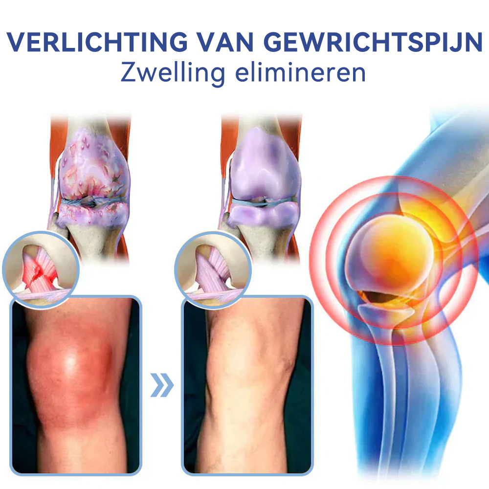 ✅𝐀𝐦𝐬𝐭𝐞𝐫𝐝𝐚𝐦 𝐔𝐌𝐂 𝐅𝐮𝐧𝐜𝐭𝐢𝐨𝐧𝐚𝐫𝐢𝐬: 𝐒𝐏𝐙𝐕® 𝐌𝐚𝐠𝐧𝐞𝐬𝐢𝐮𝐦 𝐩𝐢𝐣𝐧 𝐯𝐞𝐫𝐥𝐢𝐜𝐡𝐭𝐞𝐧𝐝𝐞 𝐡𝐞𝐥𝐞𝐧𝐝𝐞 𝐜𝐫è𝐦𝐞 (Behandeling van artritis, neuropathie, reumatische aandoeningen, spierspasmen, spiertrekkingen en sportblessures)