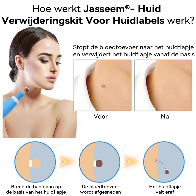 𝐉𝐚𝐬𝐬𝐞𝐞𝐦®- 𝐇𝐮𝐢𝐝 𝐕𝐞𝐫𝐰𝐢𝐣𝐝𝐞𝐫𝐢𝐧𝐠𝐬𝐤𝐢𝐭 𝐕𝐨𝐨𝐫 𝐇𝐮𝐢𝐝𝐥𝐚𝐛𝐞𝐥𝐬（Een echte fysieke oplossing voor het verwijderen van steelwratjes）🍁💖