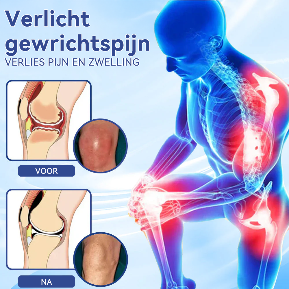 ✅𝐀𝐦𝐬𝐭𝐞𝐫𝐝𝐚𝐦 𝐔𝐌𝐂 𝐅𝐮𝐧𝐜𝐭𝐢𝐨𝐧𝐚𝐫𝐢𝐬: 𝐒𝐏𝐙𝐕® 𝐌𝐚𝐠𝐧𝐞𝐬𝐢𝐮𝐦 𝐩𝐢𝐣𝐧 𝐯𝐞𝐫𝐥𝐢𝐜𝐡𝐭𝐞𝐧𝐝𝐞 𝐡𝐞𝐥𝐞𝐧𝐝𝐞 𝐜𝐫è𝐦𝐞 (Behandeling van artritis, neuropathie, reumatische aandoeningen, spierspasmen, spiertrekkingen en sportblessures)