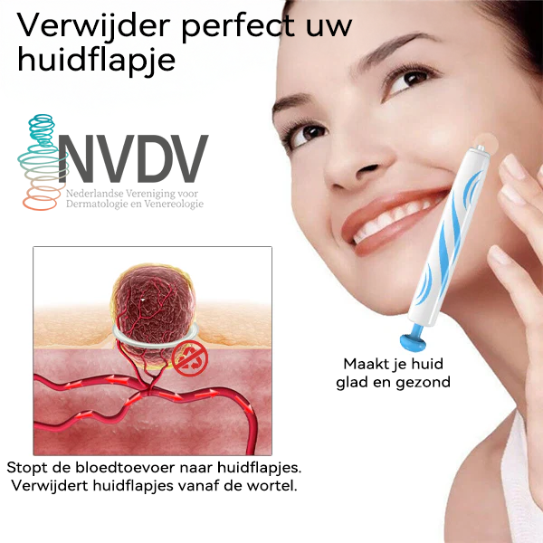 𝐉𝐚𝐬𝐬𝐞𝐞𝐦®- 𝐇𝐮𝐢𝐝 𝐕𝐞𝐫𝐰𝐢𝐣𝐝𝐞𝐫𝐢𝐧𝐠𝐬𝐤𝐢𝐭 𝐕𝐨𝐨𝐫 𝐇𝐮𝐢𝐝𝐥𝐚𝐛𝐞𝐥𝐬（Een echte fysieke oplossing voor het verwijderen van steelwratjes）🍁💖