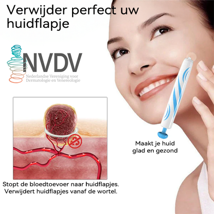 𝐉𝐚𝐬𝐬𝐞𝐞𝐦®- 𝐇𝐮𝐢𝐝 𝐕𝐞𝐫𝐰𝐢𝐣𝐝𝐞𝐫𝐢𝐧𝐠𝐬𝐤𝐢𝐭 𝐕𝐨𝐨𝐫 𝐇𝐮𝐢𝐝𝐥𝐚𝐛𝐞𝐥𝐬（Een echte fysieke oplossing voor het verwijderen van steelwratjes）🍁💖