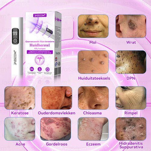𝐉𝐚𝐬𝐬𝐞𝐞𝐦®𝐆𝐞𝐚𝐯𝐚𝐧𝐜𝐞𝐞𝐫𝐝𝐞 𝐍𝐢𝐞𝐭-𝐢𝐧𝐯𝐚𝐬𝐢𝐞𝐯𝐞 𝐇𝐮𝐢𝐝𝐡𝐞𝐫𝐬𝐭𝐞𝐥 𝐂𝐎₂-𝐋𝐚𝐬𝐞𝐫𝐩𝐞𝐧(Verwijdert op milde wijze wratten, moedervlekken, ouderdomsvlekken en huidflapjes – zonder pijn en zonder gedoe!)🍁💖