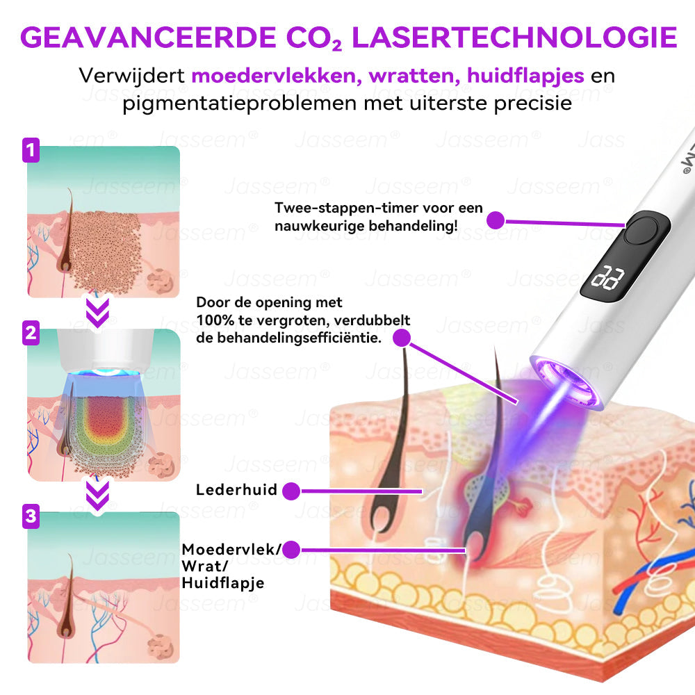 𝐉𝐚𝐬𝐬𝐞𝐞𝐦®𝐆𝐞𝐚𝐯𝐚𝐧𝐜𝐞𝐞𝐫𝐝𝐞 𝐍𝐢𝐞𝐭-𝐢𝐧𝐯𝐚𝐬𝐢𝐞𝐯𝐞 𝐇𝐮𝐢𝐝𝐡𝐞𝐫𝐬𝐭𝐞𝐥 𝐂𝐎₂-𝐋𝐚𝐬𝐞𝐫𝐩𝐞𝐧(Verwijdert op milde wijze wratten, moedervlekken, ouderdomsvlekken en huidflapjes – zonder pijn en zonder gedoe!)🌼💖