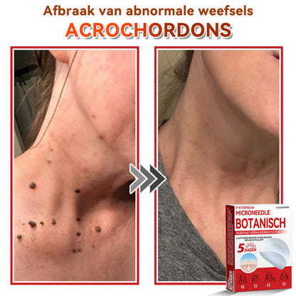 🌈𝐅𝐀𝐓𝐎𝐍𝐆® 𝐌𝐢𝐜𝐫𝐨𝐧𝐞𝐞𝐝𝐥𝐞 𝐁𝐨𝐭𝐚𝐧𝐢𝐬𝐜𝐡 𝐇𝐮𝐢𝐝𝐭𝐚𝐠 𝐕𝐞𝐫𝐰𝐢𝐣𝐝𝐞𝐫𝐞𝐧 𝐏𝐚𝐭𝐜𝐡 - Gemaakt in Nederland 🍁💖