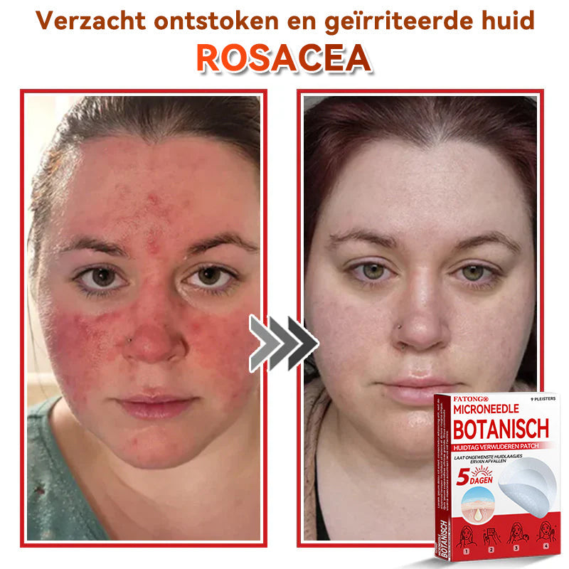 🌈𝐅𝐀𝐓𝐎𝐍𝐆® 𝐌𝐢𝐜𝐫𝐨𝐧𝐞𝐞𝐝𝐥𝐞 𝐁𝐨𝐭𝐚𝐧𝐢𝐬𝐜𝐡 𝐇𝐮𝐢𝐝𝐭𝐚𝐠 𝐕𝐞𝐫𝐰𝐢𝐣𝐝𝐞𝐫𝐞𝐧 𝐏𝐚𝐭𝐜𝐡 - Gemaakt in Nederland 🍁💖