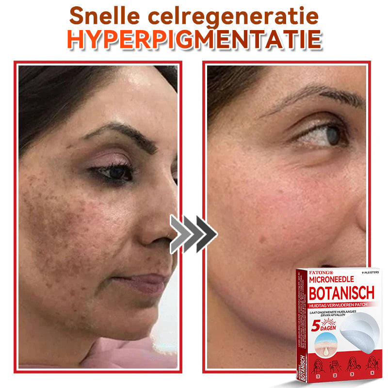 🌈𝐅𝐀𝐓𝐎𝐍𝐆® 𝐌𝐢𝐜𝐫𝐨𝐧𝐞𝐞𝐝𝐥𝐞 𝐁𝐨𝐭𝐚𝐧𝐢𝐬𝐜𝐡 𝐇𝐮𝐢𝐝𝐭𝐚𝐠 𝐕𝐞𝐫𝐰𝐢𝐣𝐝𝐞𝐫𝐞𝐧 𝐏𝐚𝐭𝐜𝐡 - Gemaakt in Nederland 🍁💖