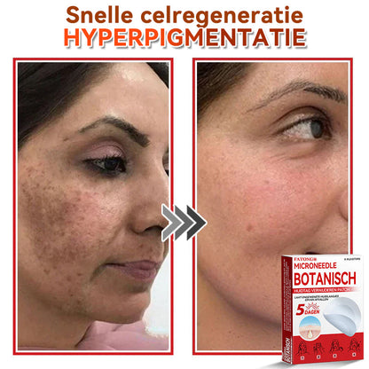 🌈𝐅𝐀𝐓𝐎𝐍𝐆® 𝐌𝐢𝐜𝐫𝐨𝐧𝐞𝐞𝐝𝐥𝐞 𝐁𝐨𝐭𝐚𝐧𝐢𝐬𝐜𝐡 𝐇𝐮𝐢𝐝𝐭𝐚𝐠 𝐕𝐞𝐫𝐰𝐢𝐣𝐝𝐞𝐫𝐞𝐧 𝐏𝐚𝐭𝐜𝐡 - Gemaakt in Nederland 🍁💖