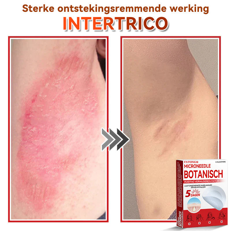 🌈𝐅𝐀𝐓𝐎𝐍𝐆® 𝐌𝐢𝐜𝐫𝐨𝐧𝐞𝐞𝐝𝐥𝐞 𝐁𝐨𝐭𝐚𝐧𝐢𝐬𝐜𝐡 𝐇𝐮𝐢𝐝𝐭𝐚𝐠 𝐕𝐞𝐫𝐰𝐢𝐣𝐝𝐞𝐫𝐞𝐧 𝐏𝐚𝐭𝐜𝐡 - Gemaakt in Nederland 🍁💖