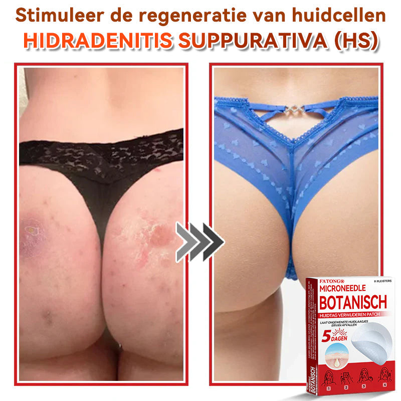 🌈𝐅𝐀𝐓𝐎𝐍𝐆® 𝐌𝐢𝐜𝐫𝐨𝐧𝐞𝐞𝐝𝐥𝐞 𝐁𝐨𝐭𝐚𝐧𝐢𝐬𝐜𝐡 𝐇𝐮𝐢𝐝𝐭𝐚𝐠 𝐕𝐞𝐫𝐰𝐢𝐣𝐝𝐞𝐫𝐞𝐧 𝐏𝐚𝐭𝐜𝐡 - Gemaakt in Nederland 🍁💖