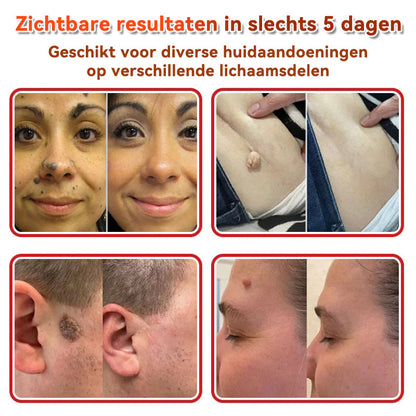 🌈𝐅𝐀𝐓𝐎𝐍𝐆® 𝐌𝐢𝐜𝐫𝐨𝐧𝐞𝐞𝐝𝐥𝐞 𝐁𝐨𝐭𝐚𝐧𝐢𝐬𝐜𝐡 𝐇𝐮𝐢𝐝𝐭𝐚𝐠 𝐕𝐞𝐫𝐰𝐢𝐣𝐝𝐞𝐫𝐞𝐧 𝐏𝐚𝐭𝐜𝐡 - Gemaakt in Nederland 🍁💖