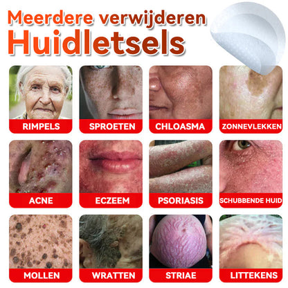 🌈𝐅𝐀𝐓𝐎𝐍𝐆® 𝐌𝐢𝐜𝐫𝐨𝐧𝐞𝐞𝐝𝐥𝐞 𝐁𝐨𝐭𝐚𝐧𝐢𝐬𝐜𝐡 𝐇𝐮𝐢𝐝𝐭𝐚𝐠 𝐕𝐞𝐫𝐰𝐢𝐣𝐝𝐞𝐫𝐞𝐧 𝐏𝐚𝐭𝐜𝐡 - Gemaakt in Nederland 🍁💖